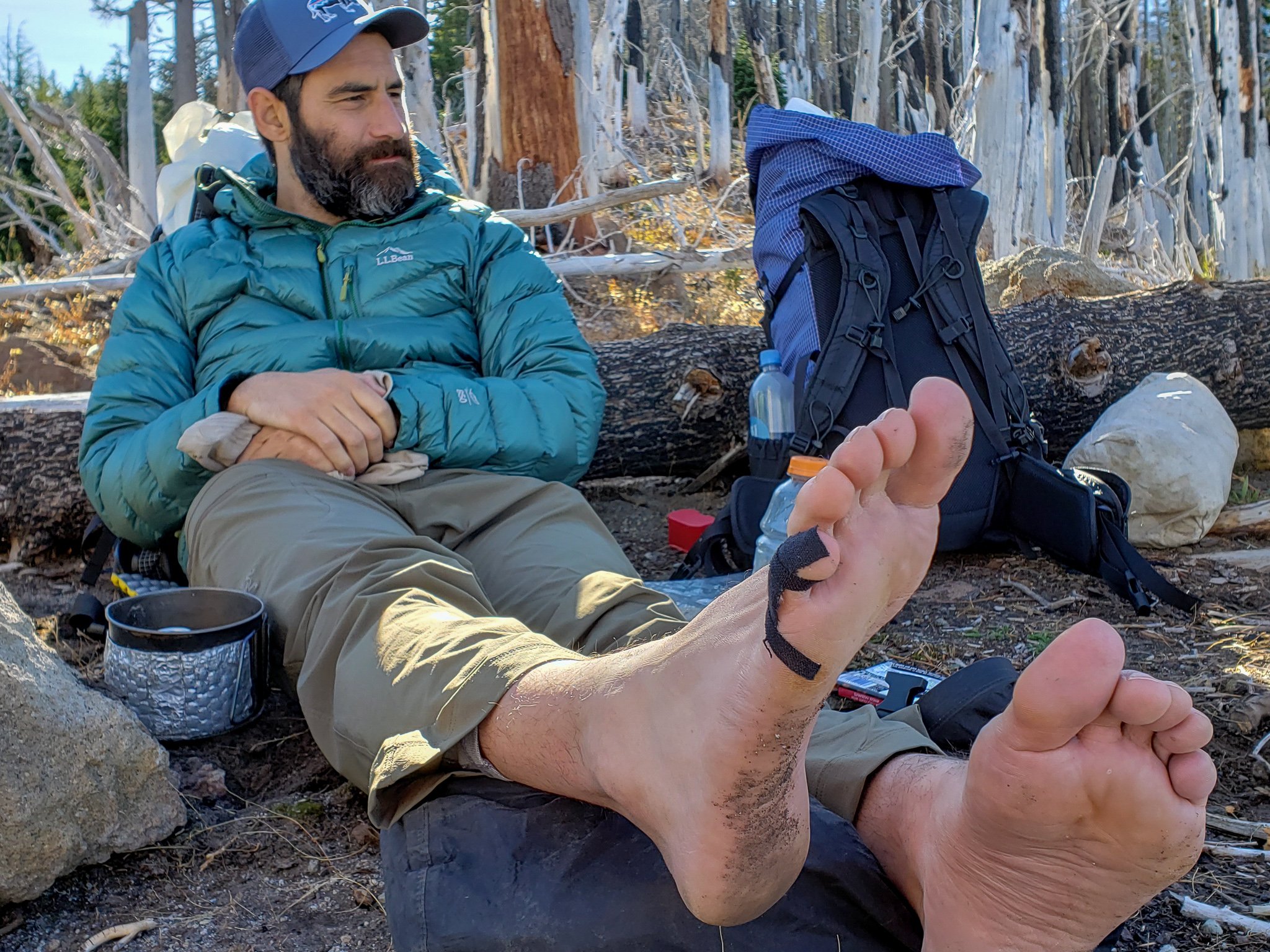 Closeup of KT tape being used to treat a blister on a backpacker's foot